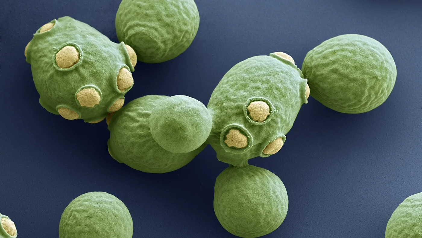 Saccharomyces cerevisiae