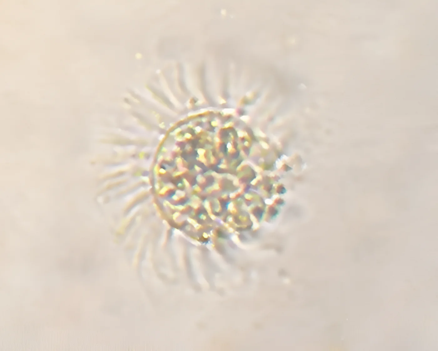 Mesodinium rubrum